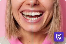 Отбеливание зубов на фотографии